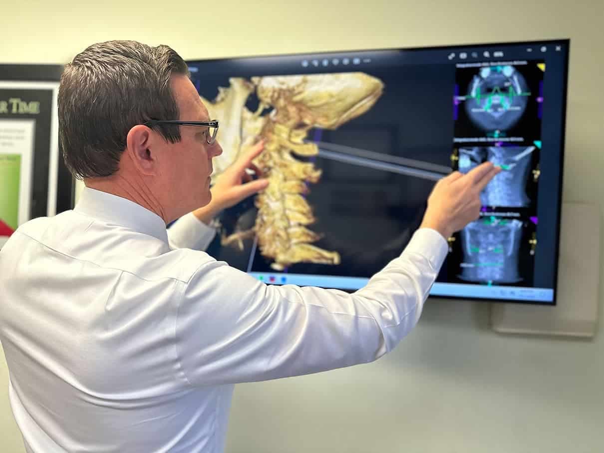 CBCT 3D imaging analysis showing precise upper cervical measurements
